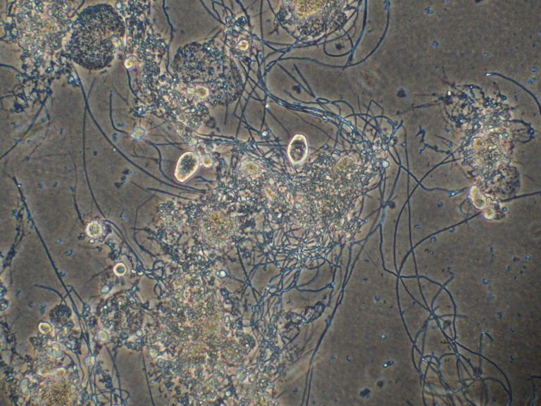 floc-characterization-filamentous-bacteria-identification